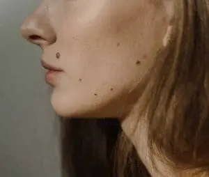 moles