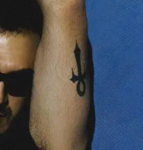 Laser Tattoo Removal