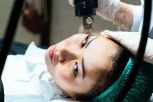 RF Microneedling Treatments in Maryland by Profile MD