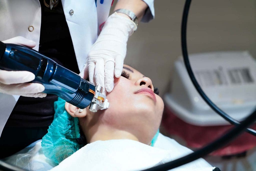 close up of an intracel microneedling RF procedure